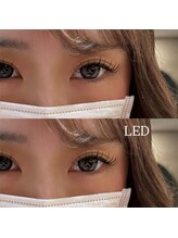 ビューティマーケット アングゥ(BEAUTY MARKET ungu)/LED