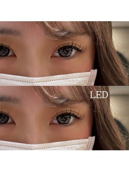 ビューティマーケット アングゥ(BEAUTY MARKET ungu)/LED