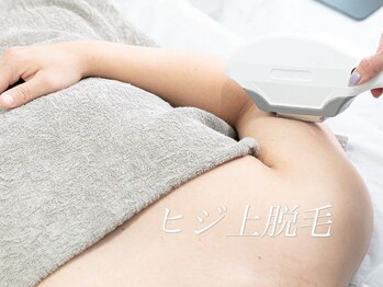 ボス 桑名駅前店(BOSS)/ 【メンズ脱毛/上半身・両肘上】