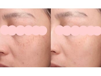 ムーンライズ(moonrise)/