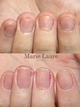 マリーロール 梅田店(Marie Laure)/深爪改善/自爪育成/ネイルケア