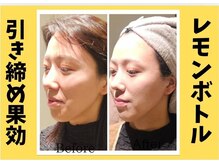 アン 銀座(ann)/♯レモンボトル