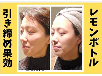 アン 銀座(ann)/♯レモンボトル