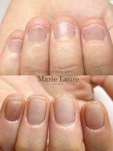 マリーロール 淀屋橋本店(Marie Laure)/深爪矯正/自爪育成/ネイルケア