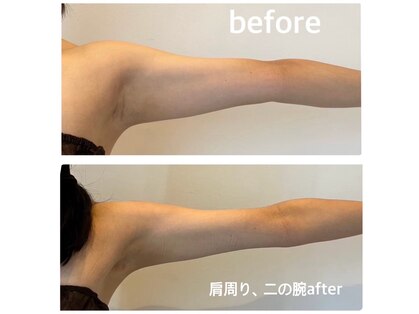 アンフィルミエール 新宿店(infirmiere)の写真