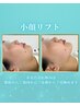 【小顔リフト】二重顎撃退◎たるみ改善 ウルセルリフト
