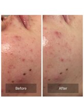 ビジュープラス 筑西下館店(Bijou+)/