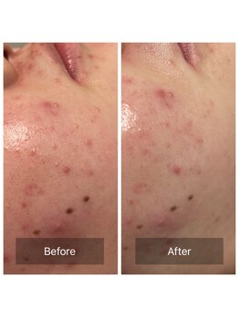 ビジュープラス 筑西下館店(Bijou+)/