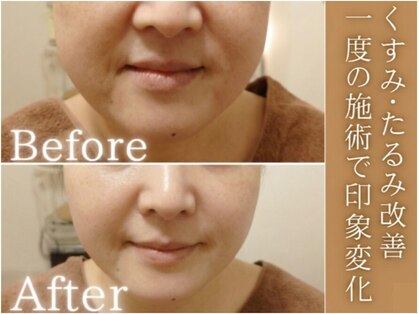 サロンドエステ ルヴニール(salon de esthe revenir)の写真