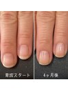 割れやすい爪を育成4ヶ月コース