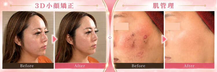 イーフェイス(e face)のサロンヘッダー