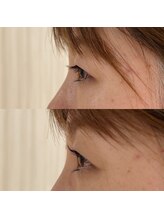 ラ シェリー(La cherie)/まつ毛パーマ