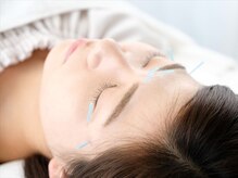 TK鍼灸院の雰囲気（美容鍼でむくみたるみ改善!スッキリ小顔に!ヘッドスパもおすすめ）