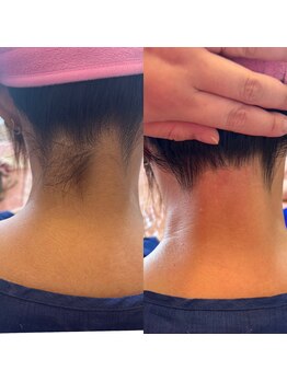 リセット エム(Reset..m)/シュガーリング脱毛☆