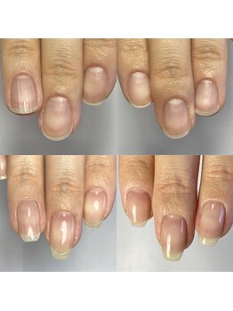 ラピスラズリ(lapislazuli)/◇自爪育成◇