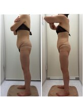 リッツ ひばりが丘パルコ店/【Before/After】痩身