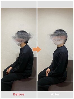 エイト鍼灸 整骨院 表参道(8eight鍼灸 整骨院)/全身整体【鍼灸/整体/肩こり】