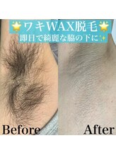 ハニーアイズ(Honey Eyes)/WAX1回で！両わきツルツル！！