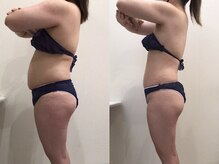 ビラ 銀座店(BILA)/キャビラジ