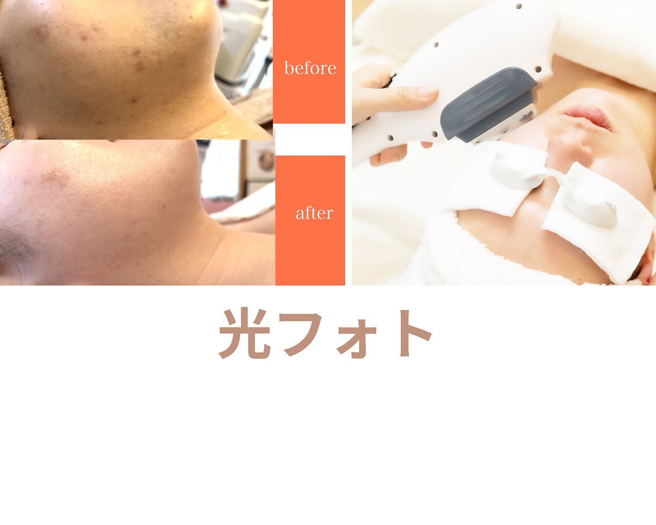 サロン ベル 八幡市(salon belle)｜ホットペッパービューティー