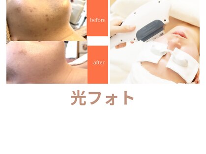 サロン ベル 八幡市(salon belle)の写真