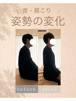 アオ 香椎(AO)/before→after