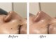サラ 神楽坂(Sara)の写真/★話題の水光アクアピールで叶える毛穴レスな透明感をぜひ♪