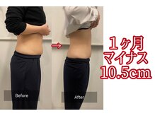 キレピア 新市街店(kirepia)/