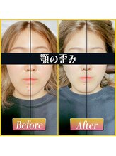 てんてんてんまてん/小顔矯正/骨盤矯正/整体/肩こり