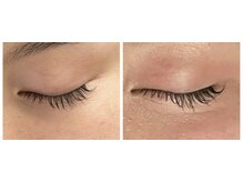 ポエマ(POEMA)/ホームケアでお悩み解決◎