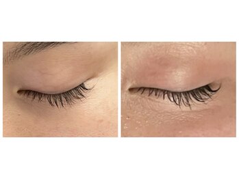 ポエマ(POEMA)/ホームケアでお悩み解決◎