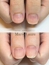 マリーロール 梅田店(Marie Laure)/深爪改善/自爪育成/ネイルケア