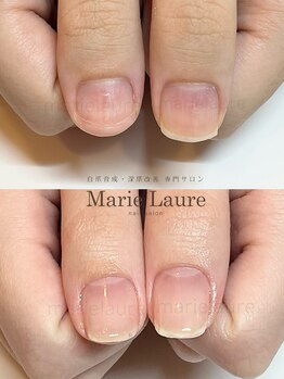 マリーロール 梅田店(Marie Laure)/深爪改善/自爪育成/ネイルケア