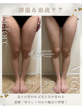 アンジェーム(ANGEAME)/深温&血流ケア