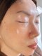 サロン ベレ プー(Salon Belle Peau)の写真/【人気の組み合わせメニューご用意】毛穴洗浄×幹細胞導入￥4980！理想に合わせてオーダーメイド施術可能◎