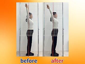 ストレッチヒーロー 福山神辺店/ビフォーアフター【1回の変化】