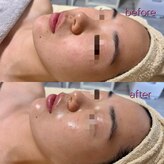 リボーン(be reborn)