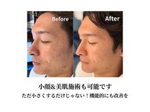 カラダコンシェルジュN(KARADAコンシェルジュN)/小顔だけじゃない！美肌も叶う