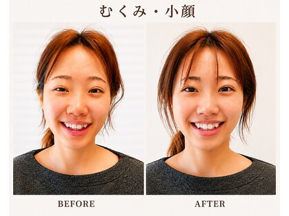 サプリ 梅田の写真
