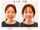 サプリ 梅田の写真