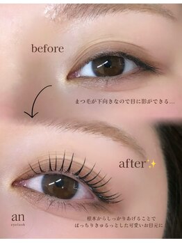 アン(an)/【 before →after 】