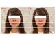 ミイナ(Mina)の写真/【小顔＆リフトアップ】マシン×深層ハンド技術でキュッと引き締まった理想のフェイスラインへ♪