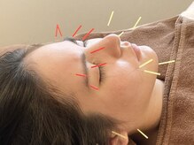 たから鍼灸院