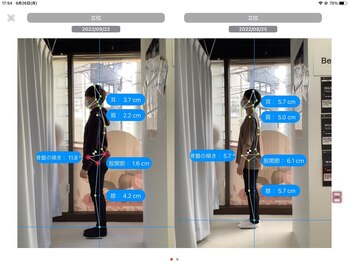 ナオル整体 大森店(NAORU整体)/20代男性、継続施術１ヶ月経過後