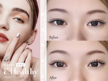 エクララ(eclala)