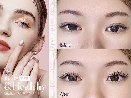 エクララ(eclala)の写真