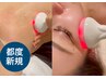 【都度新規】小顔フェイスラインリフトアップ×背中肩こり解消★高周波¥8800