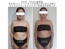 エクラリュクス アオヤマ(eclat Luxe AOYAMA)の雰囲気（頭の位置/首は長くなり小顔に♪法令線/フェイスライン/華奢みえ）