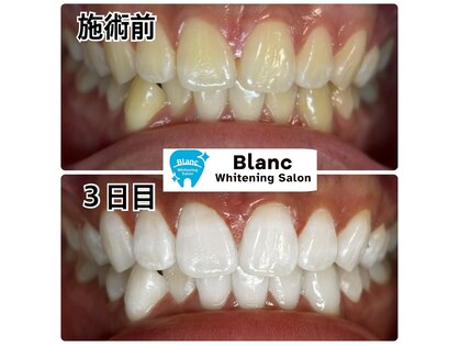 ブラン 心斎橋店(Blanc)の写真