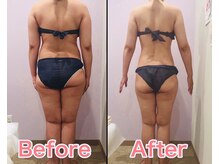 ナレル(narrel)の雰囲気(ただ痩せるだけじゃない、姿勢も美しくなるのが当店のこだわり!)